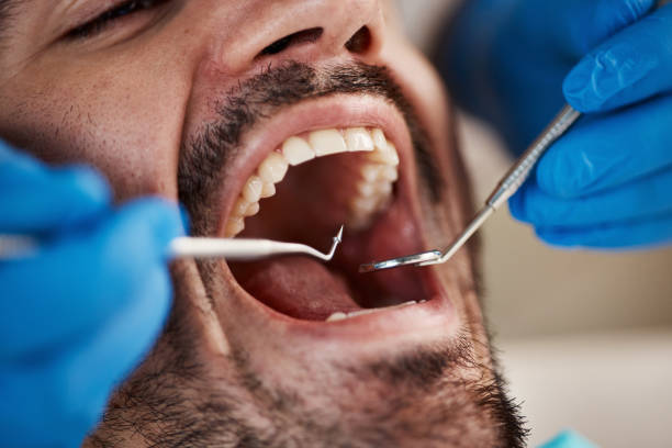 Best Teeth Whitening  in Coldwater, MI